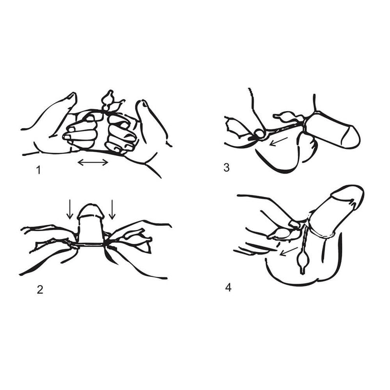 MAINTAIN® Constriction Loop for ED and PE